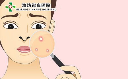 痤疮,痤疮病因,儿童痤疮病因